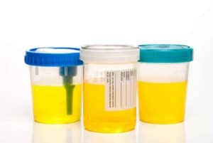 WI Drug TEsting random drug testing