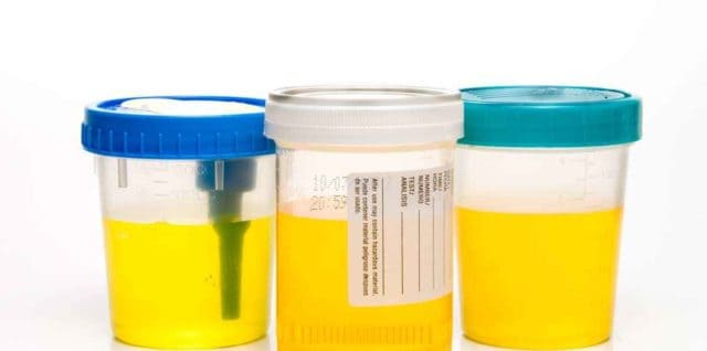 WI Drug TEsting random drug testing