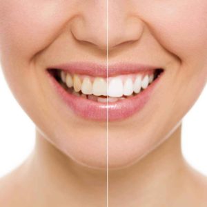 RLJ Dental aesthetic dentistry