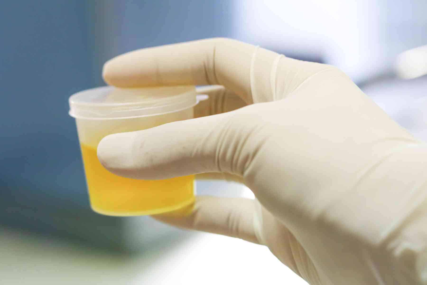 You are currently viewing WDTC’s array of drug testing centers make testing convenient