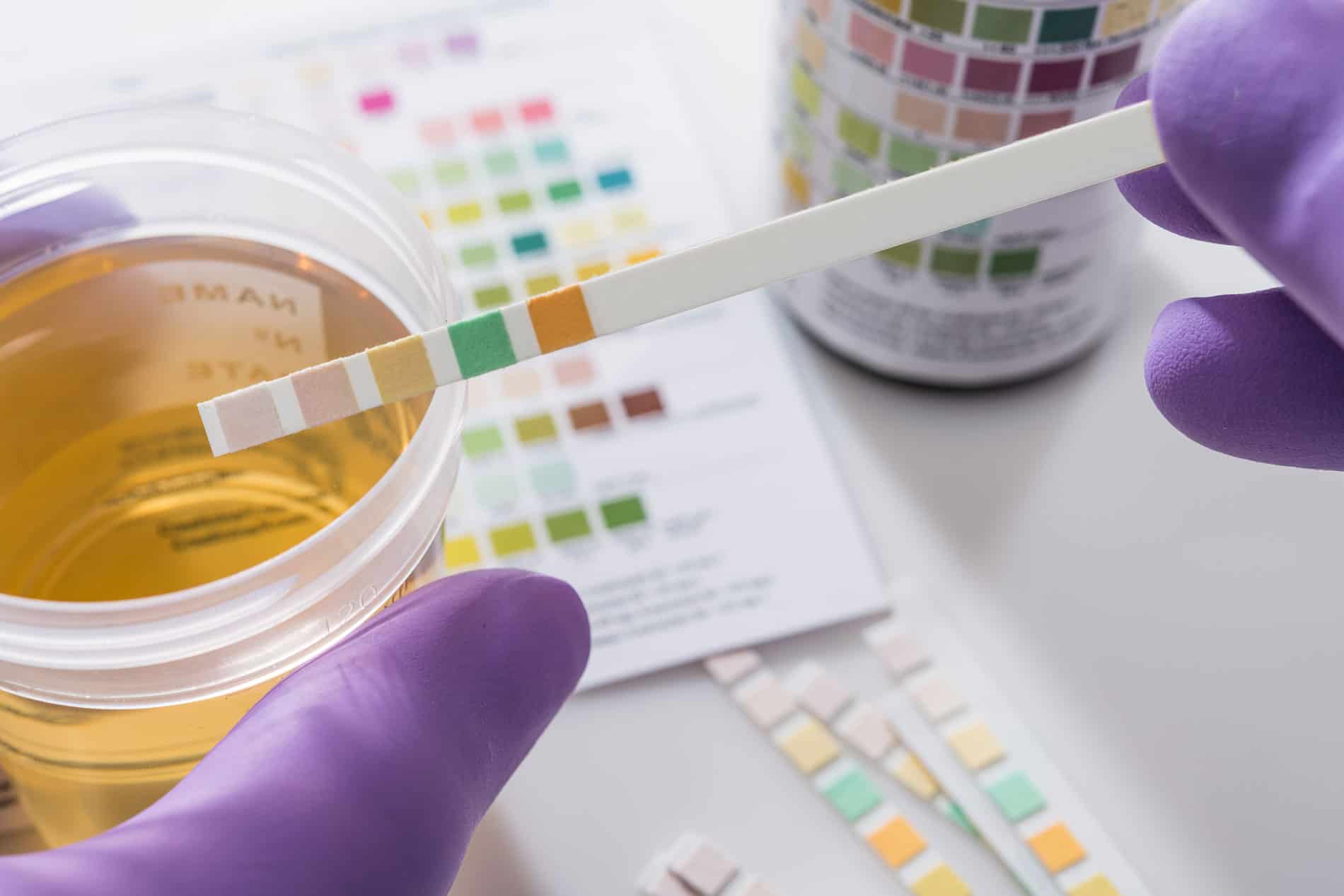 5 panel Drug Test Requirements Differ Between DOT And Non DOT